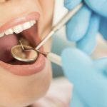 Dentists and Teeth whitening 2