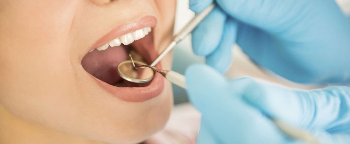 Dentists and Teeth whitening 2
